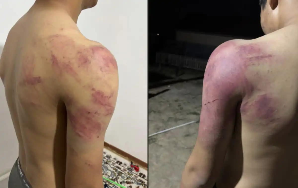 Атырауда жасөспірімдер 8-сынып оқушысын аяусыз соққыға жыққан