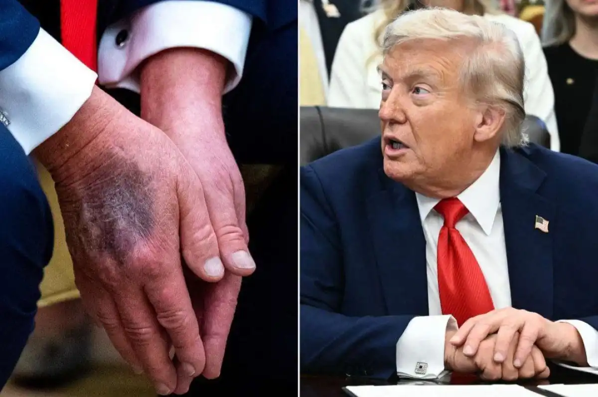 Трамп қайтыс болды ма? Америка дүрлігіп жатыр